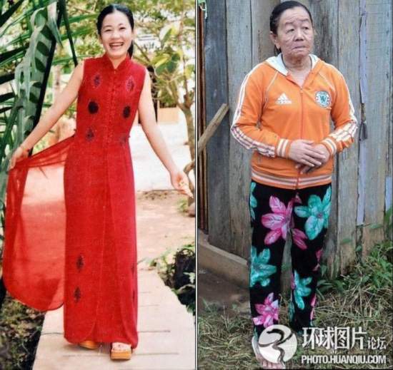 難以置信的罕見(jiàn)怪病:忘記呼吸 靜電過(guò)敏 聽(tīng)鬧鐘響心臟停跳
