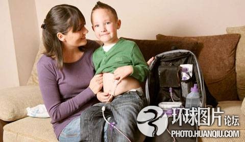 難以置信的罕見怪病:忘記呼吸 靜電過敏 聽鬧鐘響心臟停跳