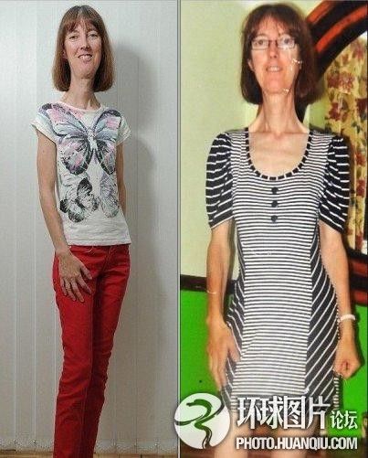 難以置信的罕見怪?。和浐粑?靜電過敏 聽鬧鐘響心臟停跳