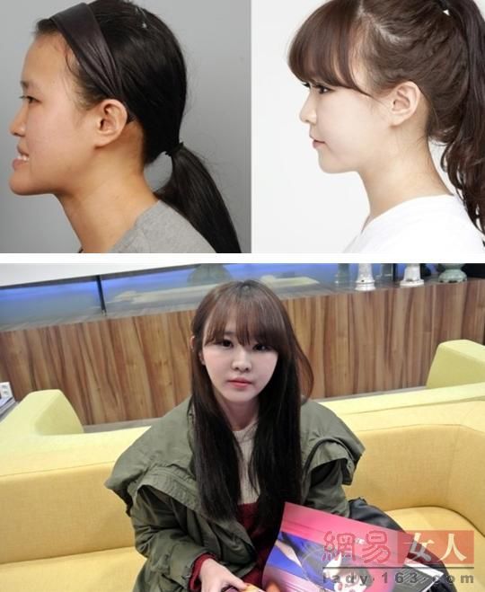 丑女變靚妹！韓國整容節目爆紅