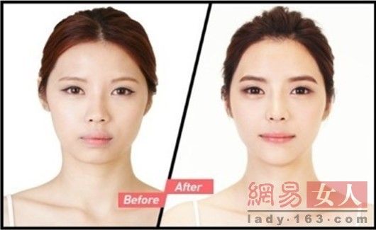 丑女變靚妹！韓國整容節目爆紅