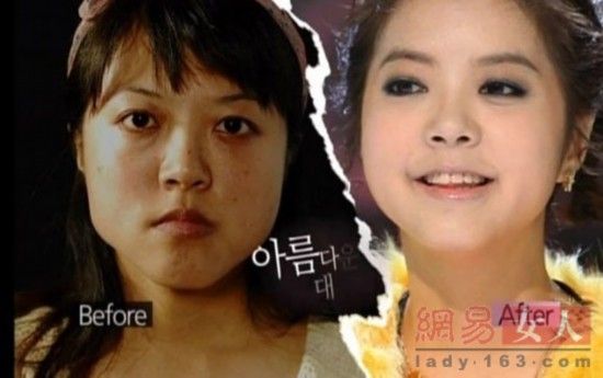 丑女變靚妹！韓國(guó)整容節(jié)目爆紅