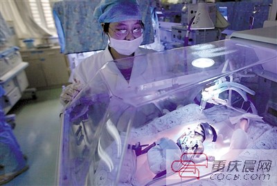 23周！重慶第一早產(chǎn)兒“筷子寶寶”正在頑強(qiáng)存活著