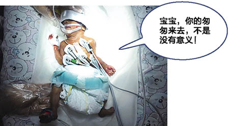 重慶“筷子寶寶”昨凌晨離世：我來過了 世界很溫暖