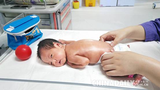 河北生殖婦產醫(yī)院精心呵護早產兒 讓其轉危為安
