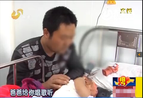 棗莊一歲男嬰被滾燙熱水從頭澆下 大面積嚴重燙傷