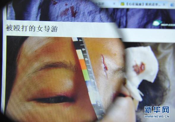 安徽黃山:一富家子弟毆打女導游引發爭議