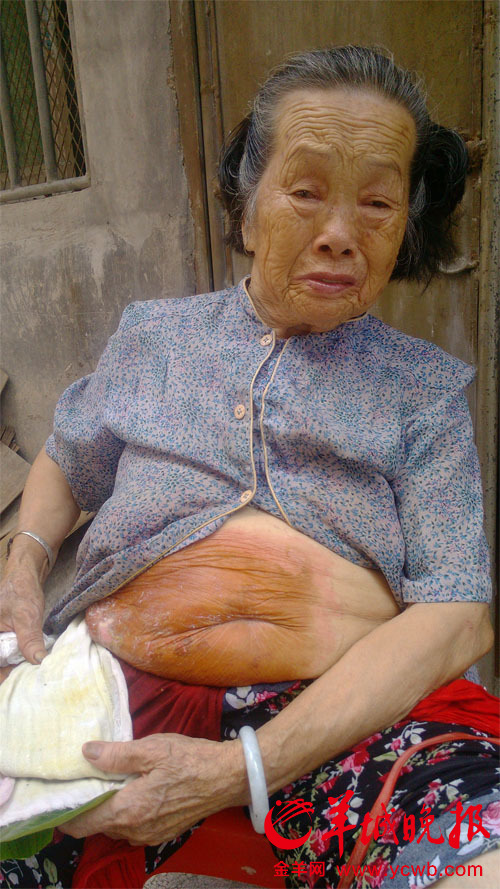 三兒數棟房拒贍養 79歲老人撤訴:不想他們坐牢