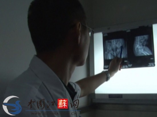 江蘇淮安女嬰體內(nèi)取出4根縫衣針 或為人為扎入