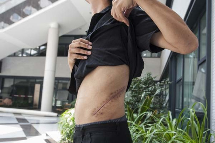 高清:記者暗訪半月揭販腎黑幕 警媒聯(lián)手破地下販腎案