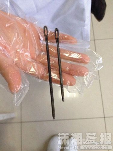 男子為愛(ài)吞兩顆長(zhǎng)釘 兩年后釘子鉆出肚皮(圖)
