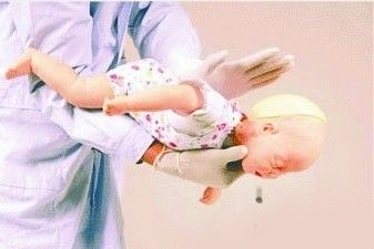 親友執意喂食 1歲半幼女核桃仁卡住喉嚨險窒息