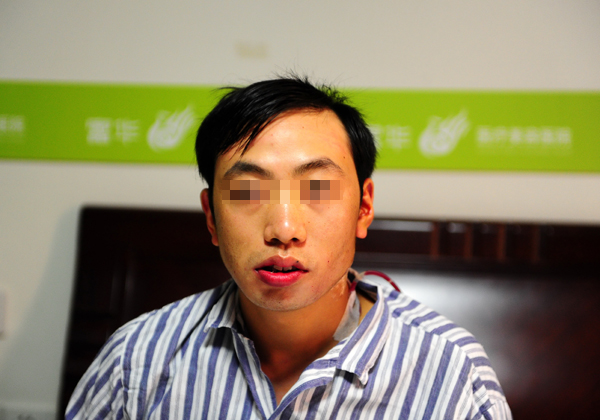 重慶“歪臉”小伙深圳獲資助 手術(shù)助其恢復正常容貌