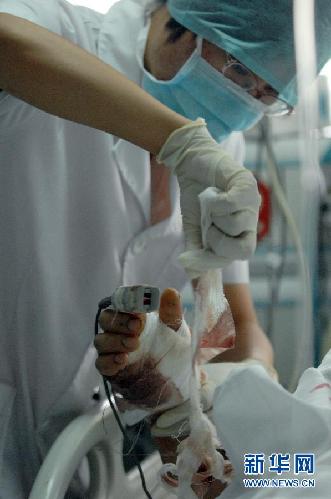 溫州動車事故：24小時守護的ICU
