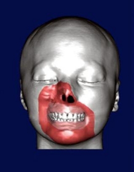Woman says 'merci' after face transplant