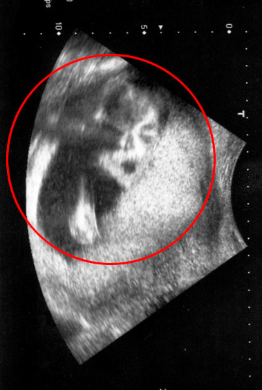 孕婦做胎兒檢查 肚子里竟出現歌王杰克遜的影像