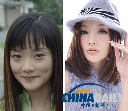 柳巖李小璐楊冪　女星整容前驚人對(duì)比照