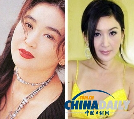 柳巖李小璐楊冪 女星整容前驚人對比照