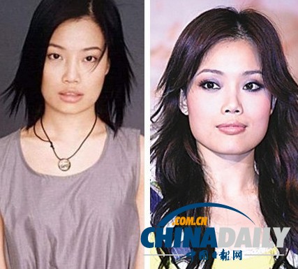 柳巖李小璐楊冪 女星整容前驚人對(duì)比照