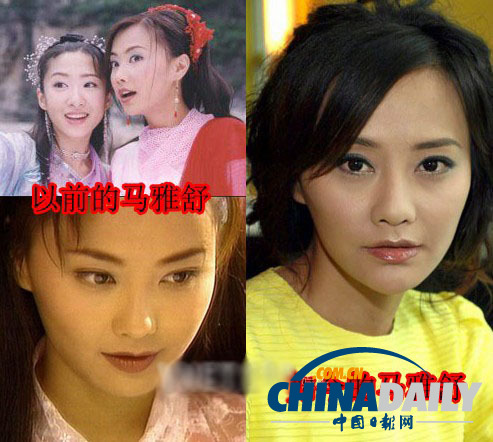 柳巖李小璐楊冪　女星整容前驚人對比照