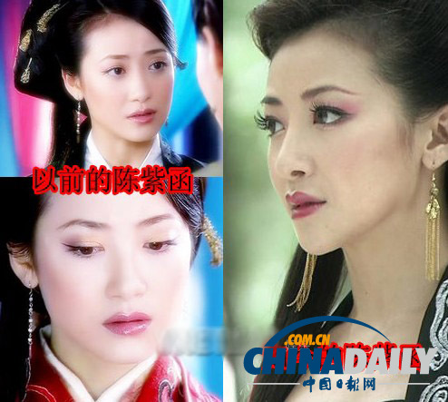 柳巖李小璐楊冪 女星整容前驚人對(duì)比照