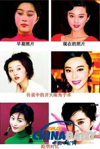 柳巖李小璐楊冪 女星整容前驚人對(duì)比照