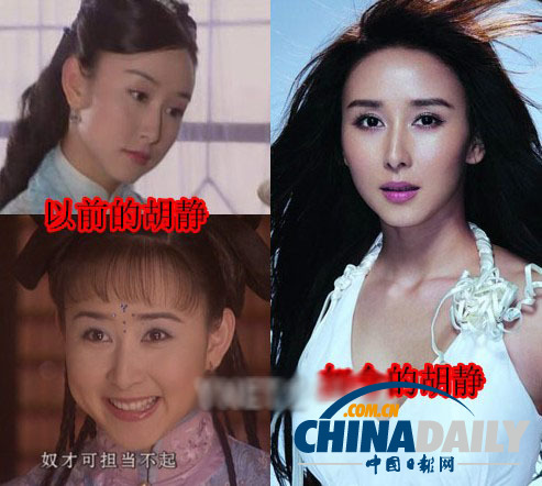 柳巖李小璐楊冪 女星整容前驚人對比照