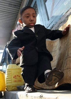 尼泊爾少年今成世界最矮人 夢想坐手袋周游世界