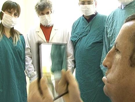 全球首例四肢移植手術完成 耗時20小時50名醫生參與