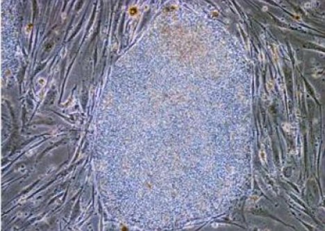 日本科學家造出“癌癥殺手”細胞 系全球首創(chuàng)有望注射使用