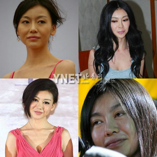 明星整容慘面癱 大S李小璐越發詭異