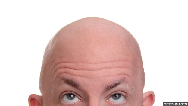 Baldness 禿頭的煩惱