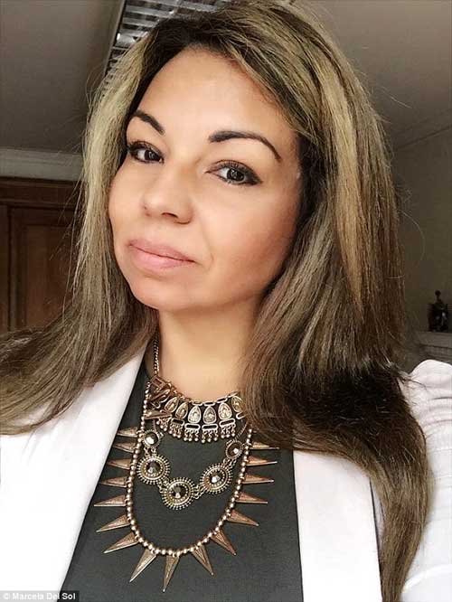 澳女子車禍后出現八重人格