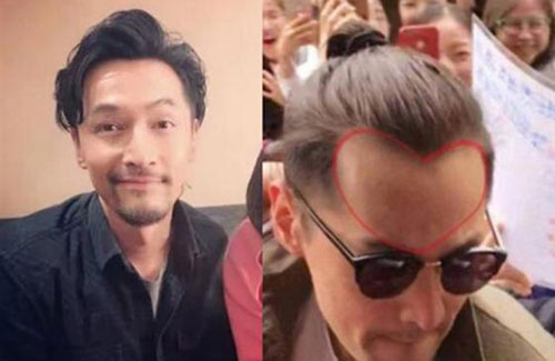 為什么男性禿頭都禿成一個樣？心疼男神們的發際線