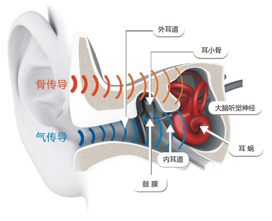 骨傳導相關漲停背后，關于AfterShokz這頭深海藍鯨
