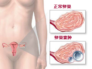 警惕：八種生活習慣可能招來癌癥(圖)